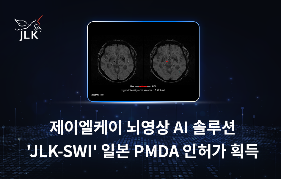 출처 : 인터넷 바카라 사이트
