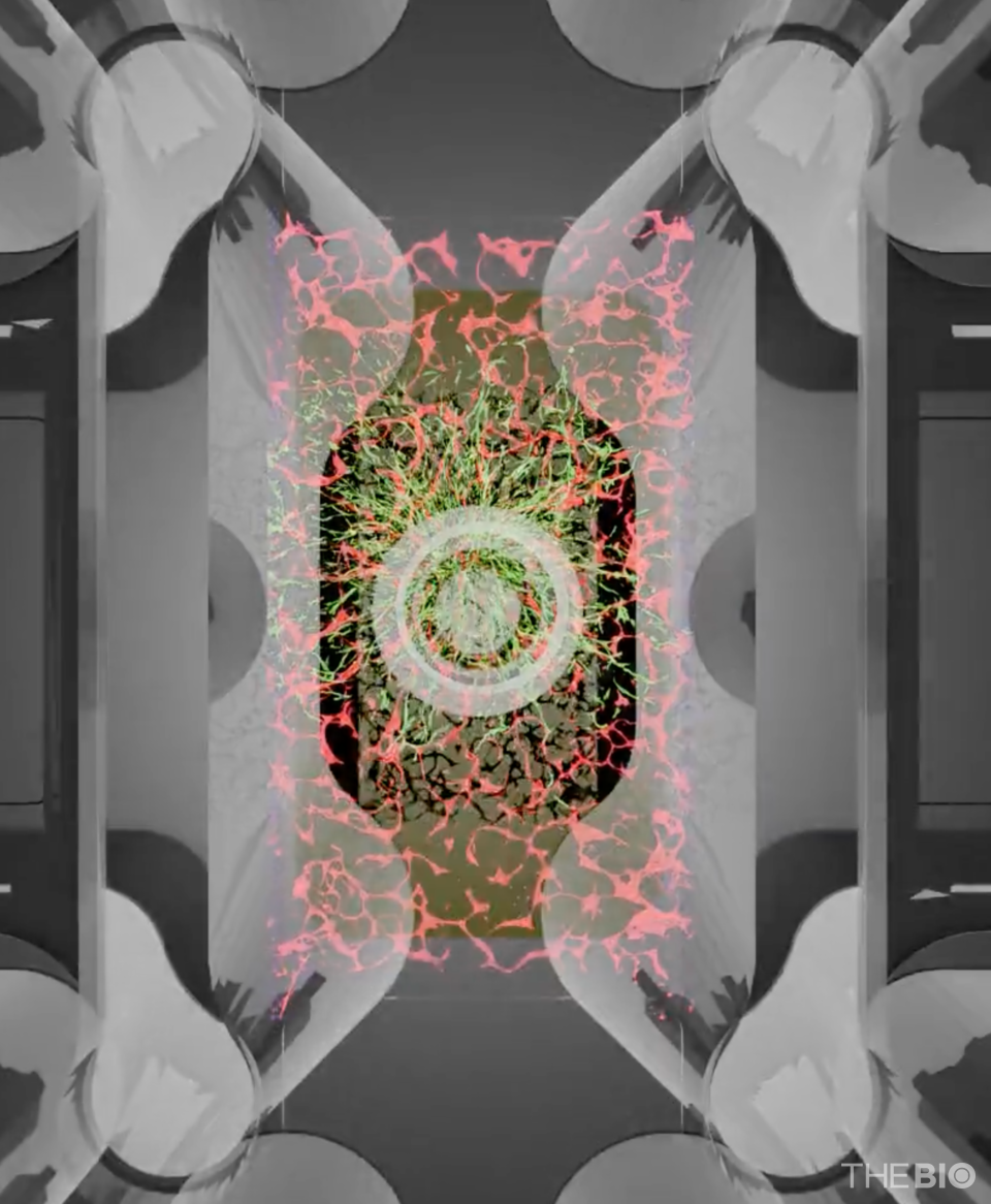 The Curiochip, an organ-chip cancer model developed by Qureator (Source: Qureator)