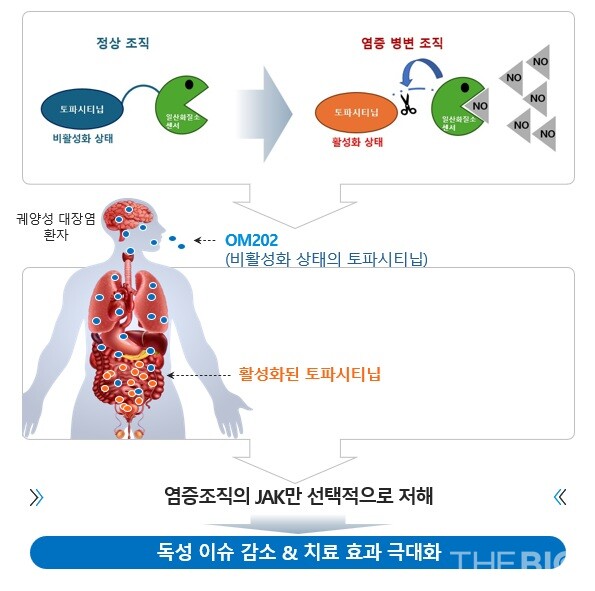 궤양성 대장염 신약 후보물질 ‘OM202’ 모식도 (출처 : 바카라사이트 검증)