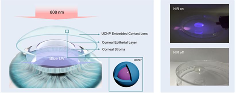 출처 : 세브란스병원