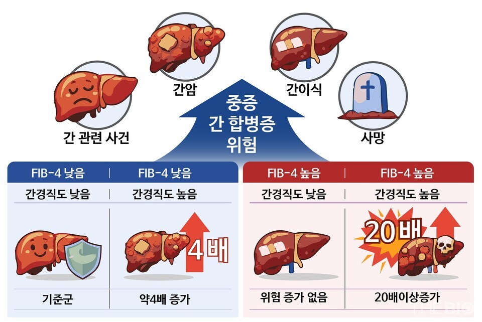 MASLD 바카라 전략에서 FIB-4 지수와 간경직도 수치에 따른 중증 간 합병증 발생 위험 결과 (출처 : 세브란스병원)