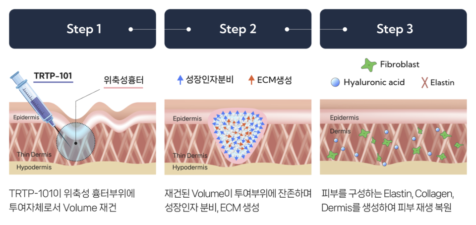 Overview of the mechanism of action of TRTP-101. (Source: 바카라사이트 정보)