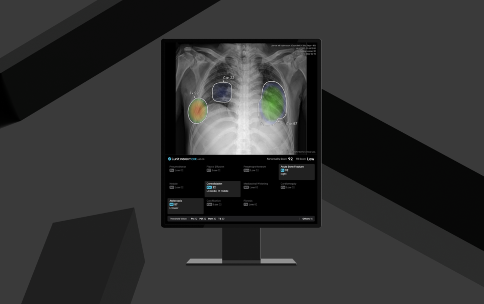 ‘루닛 인사이트 CXR4’ 사진 (출처 : 루닛)