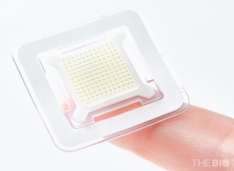 대웅테라퓨틱스가 개발한 마이크로니들 패치의 약물층을 시각적으로 표현하기 위해 색소를 첨가하고 확대 촬영한 모습 (출처 : 메이저 바카라사이트 캡틴)