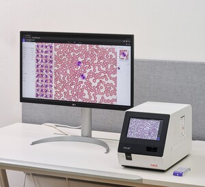 노을 “AI 진단 플랫폼 ‘마이랩’, 말라리아·급성 백혈병 진단 ‘민감도 100%’”